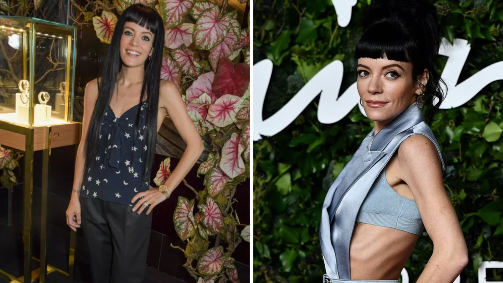 Lily Allen Weight Loss